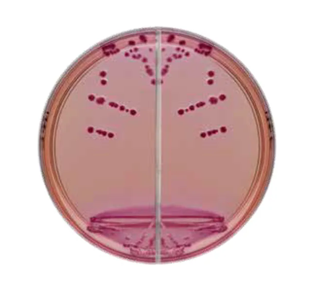 Plate Yersinia Agar 100Mm 10Ea MRS Labs Plate Yersinia Agar 100Mm 10Ea MRS Labs